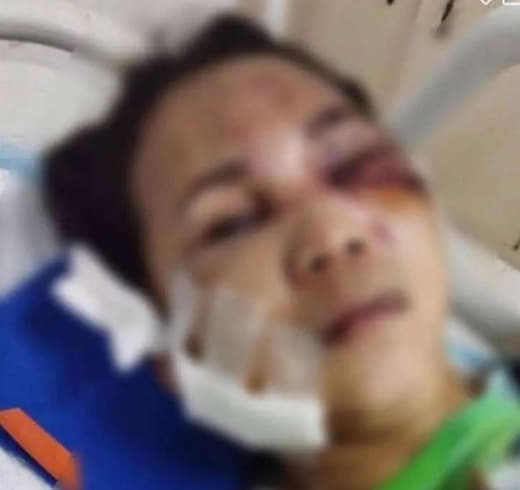 网络斗鸡害死人！菲律宾一单亲妈妈遭“吸毒赌博男”连捅10刀，生命垂危…...